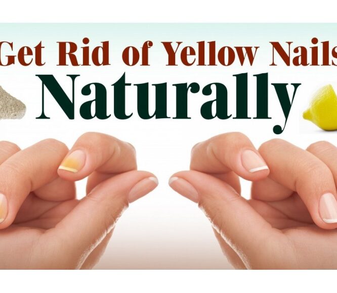 Evescafe | Whiten Yellow Nails - Remove Nail Polish Stains |Tips to Get rid of Yellow Nails