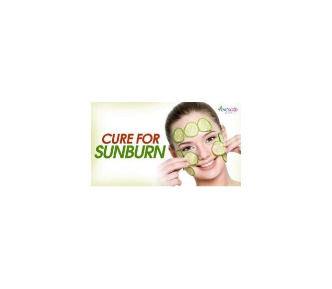 Evescafe | Quick sunburn relief - Sunburn treatment and remedies