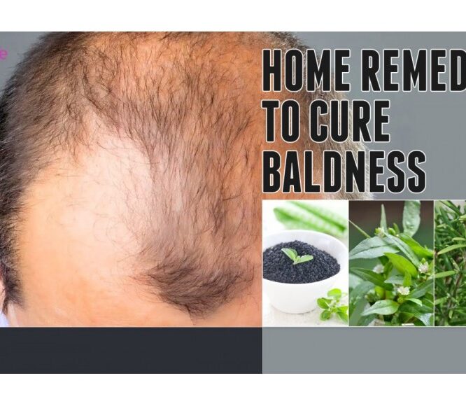 How to treat baldness or regrow hair on bald spot | HOME REMEDY