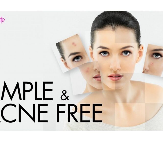 Home Remedies for Acne, Pimple and Cystic Acne